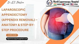 Laparoscopic Appendectomy: Anatomy and Step-by-Step Appendix Removal Procedure