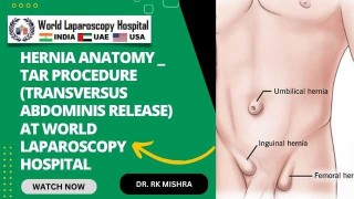TAR Anatomy Explained: Key Insights into Abdominal Wall Reconstruction