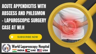 Complex Appendicitis: Laparoscopic Management of Abscess & Phlegmon