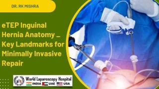 Understanding eTEP Anatomy: Landmarks for Safe Hernia Repair