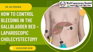 Bleeding in Gallbladder Bed: Laparoscopic Hemostasis Techniques