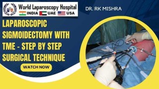 Stepwise Laparoscopic Sigmoidectomy with Total Mesorectal Excision