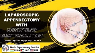 TAPP Laparoscopic Hernia Repair using Fibrin Glue by Dr R K Mishra