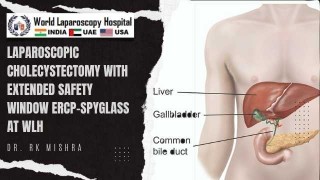 Safe Use of Electrosurgery in Laparoscopy Part II - Lecture by Dr R K Mishra