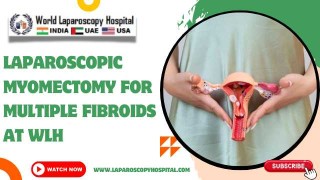 Laparoscopic Removal of Ovarian Teratoma