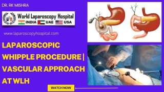 Laparoscopic Whipple Procedure with Vascular Control: A High-Expertise Approach