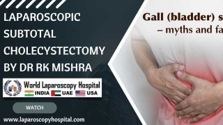 Innovative Solutions in Difficult Gallbladders: Laparoscopic Subtotal Cholecystectomy