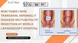 Mini-TAMIS Innovation: Scar-Free Transanal Resection for Rectal Polyps