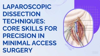 Minimally Access Approach: Laparoscopic Ovarian Cystectomy Explained by Dr. R.K. Mishra