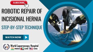 Laparoscopic Repair of Recurrent Incisional Hernia by Two Port by Dr R K Mishra