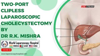 Laparoscopic Mishra's Knot