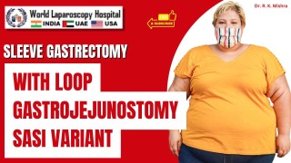 SASI Variant: Sleeve Gastrectomy with Loop Gastrojejunostomy in Advanced Bariatric Practice