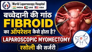 बच्चेदानी की गांठ (Fibroid) का ऑपरेशन कैसे होता है? | रसोली की सर्जरी | बिना बड़ा चीरा आधुनिक इलाज
