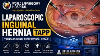 TAPP Hernia Surgery by Dr. R.K. Mishra | Advanced Minimally Invasive Technique