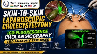 Laparoscopic Cholecystectomy with ICG | CBD Anatomy Explained by Dr. R. K. Mishra