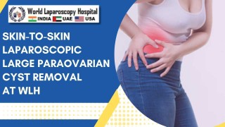 Large Paraovarian Cyst Removed Laparoscopically | Skin-to-Skin Paraovarian Cystectomy
