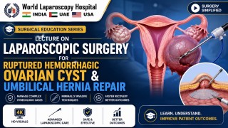 Skin-to-Skin Laparoscopic Ovarian Cyst & Umbilical Hernia Repair by Dr. R. K. Mishra