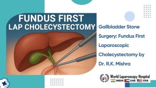 Skin-to-Skin Fundus First Laparoscopic Cholecystectomy Using Mishra's Knot Technique