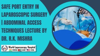 Mastering Laparoscopic Abdominal Entry | Veress Needle, Hasson Open & Optical Trocar Access