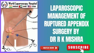 Ruptured Appendix Surgery | Laparoscopic Appendectomy by Dr. R.K. Mishra at WLH