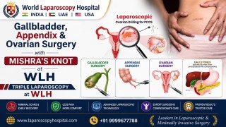 Triple Surgery | Cholecystectomy, Appendectomy & Ovarian Drilling Using Mishra’s Knot