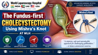 Fundus-First Cholecystectomy Using Mishra’s Knot | Top-Down Technique at WLH