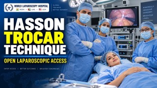 Hasson Trocar Technique Explained | Safe Open Laparoscopic Entry by Dr. R.K. Mishra