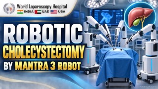Robotic Cholecystectomy with Mantra 3 | Advanced Gallbladder Surgery at WLH